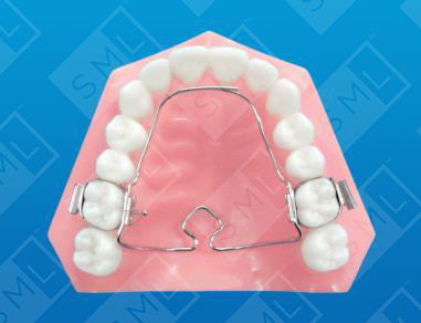 3D multiaction palatal appliance_0