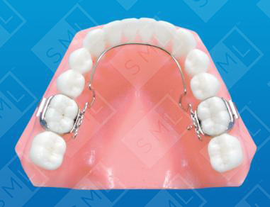 3d lingual arch l_0
