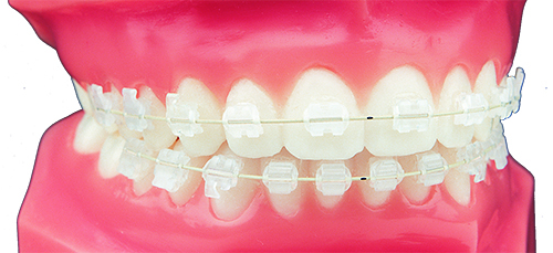 Ortho