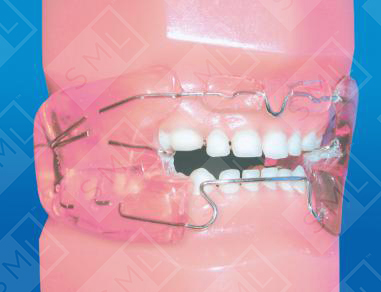 9_3503_I_0_0