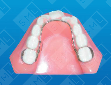 Adjustable Loop Lingual