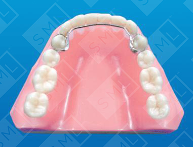 Banded 4x4 Retainer