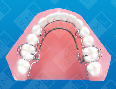 Basic Mandibular Crozat Lingual Springs