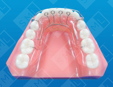 Bloore Aligner