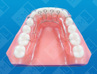 Bloore Aligner