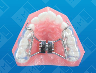 Bonded Maxillary Face Mask Expansion App