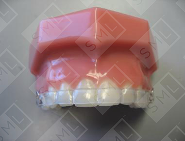 COR Functional Retainer-Adjustable 003_0