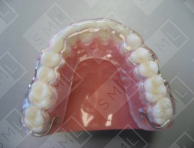 COR Functional Retainer-Adjustable 009
