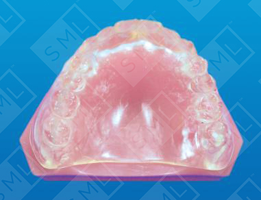 CT Scan Appliance for the fully edentulous patient