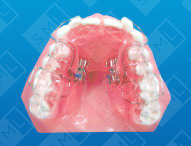 Class II Div 2 Sagittal App