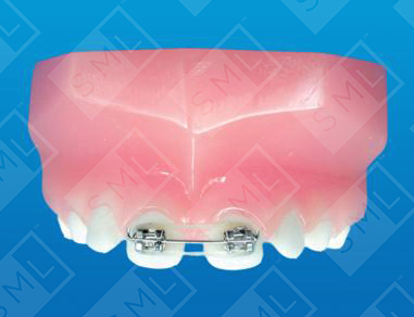 Diastema Controller_0