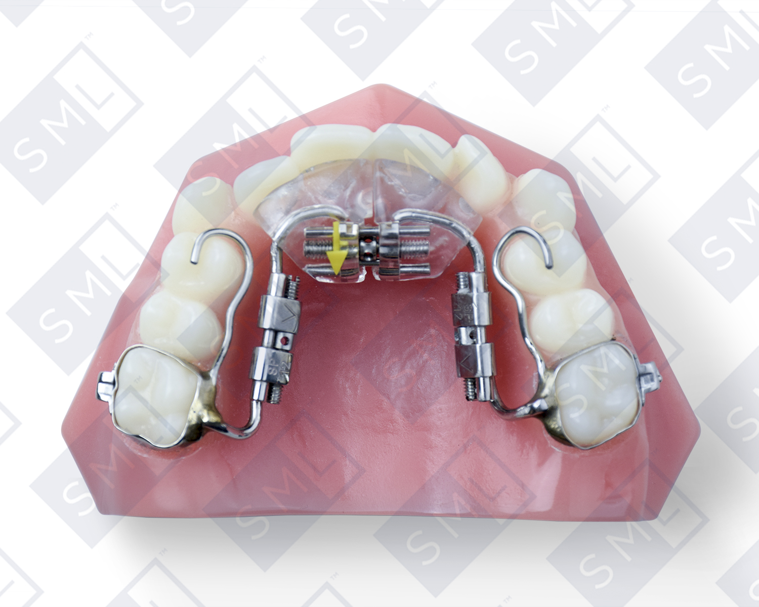 Fixed 3-Way Sagittal_watermarked