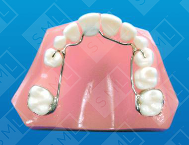Fixed Banded Temporary Anterior Bridge
