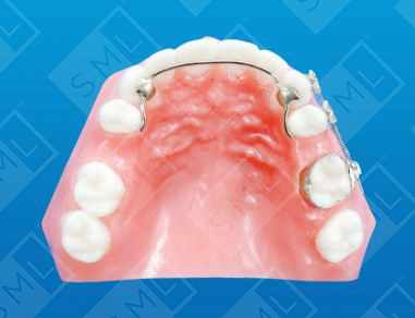 Fixed Sectional Distalizer
