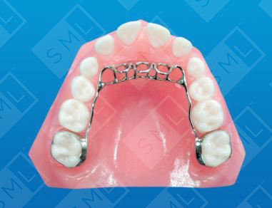 Fixed Tongue Loops_0
