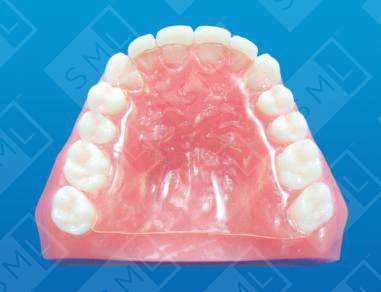 GingivalStent_0