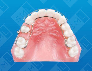 Gurin Lock Regainer