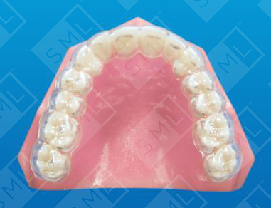 Invisible Retainer