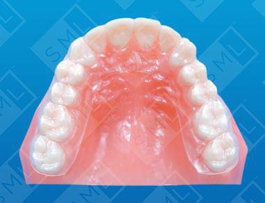 Invs Retainer