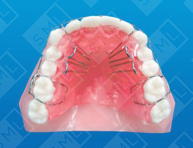 Lateral Tongue