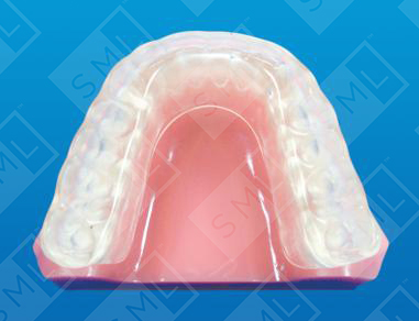 Levandoski Stabilization Prosthesis
