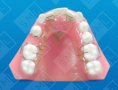 Lower Active Partial