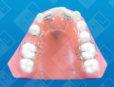 Lower Treatment Partial with Tooth Movement