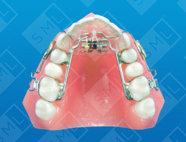 Magill Sagittal to Advance