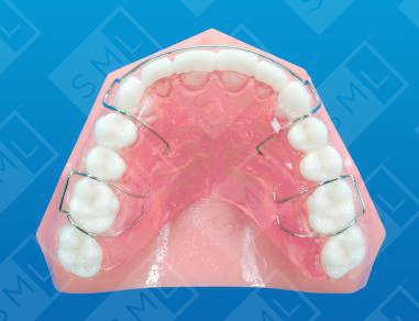 Max Final Retainer