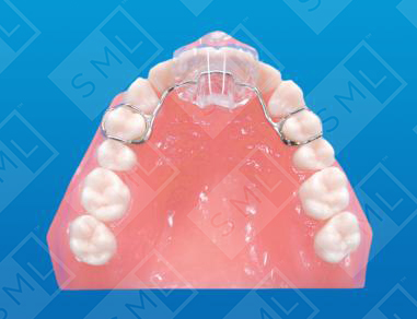 Maxillary Anterior Night Splint