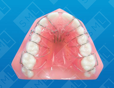 Mesial and Lingual Anterior Movement_0