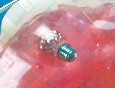 Micro-ScrewReplacements
