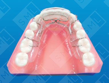 Modified Spring Retainer 2_0
