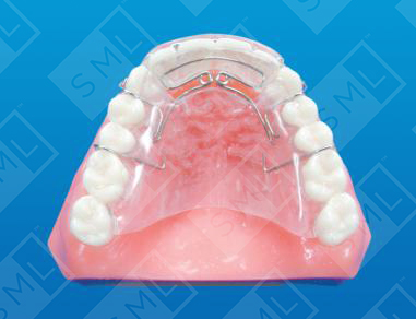 Modified Spring Retainer_0