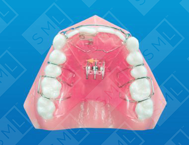 Moving Anterior Labially_0