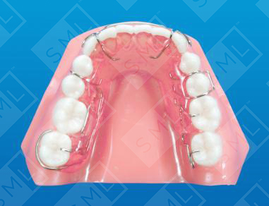 Multi Spring Molar Uprighter