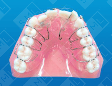 MultiSpring Appliance Mesial Distal Anterior Positioning_0