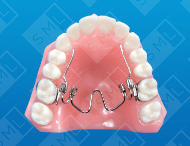 Nitanium Palatal Expander