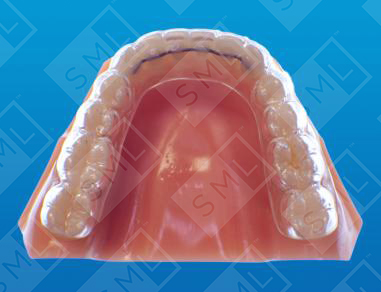 Powerprox-Final-Retention-System2