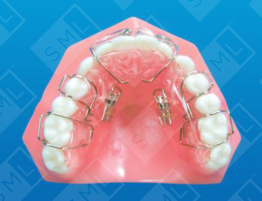 PreMaxillary Development Sagittal with Frankel Pads_0