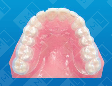 Protective Splint_0