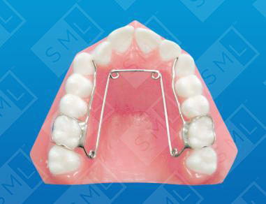 Quad Helix U
