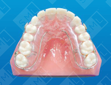 RAM Retainer