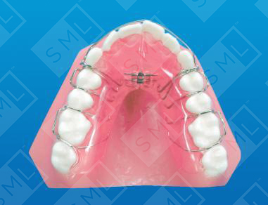 Reduced Acrylic Shwarz