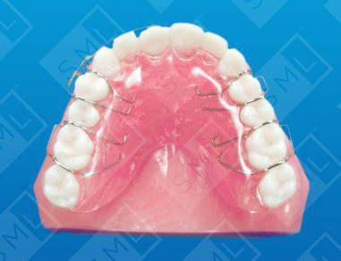 Removable Forced Eruption Appliance Spring Activated