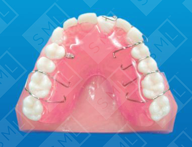Removable Forced Eruption Appliance