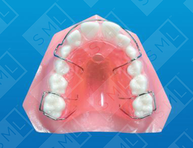 Removable Tongue Positioner