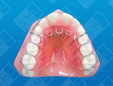 Removable Tongue