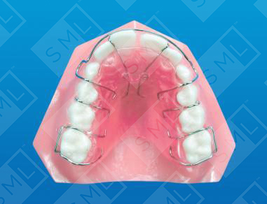 Removable with Anterior Finger_0