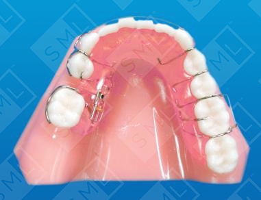 Removal Space Regainer_0